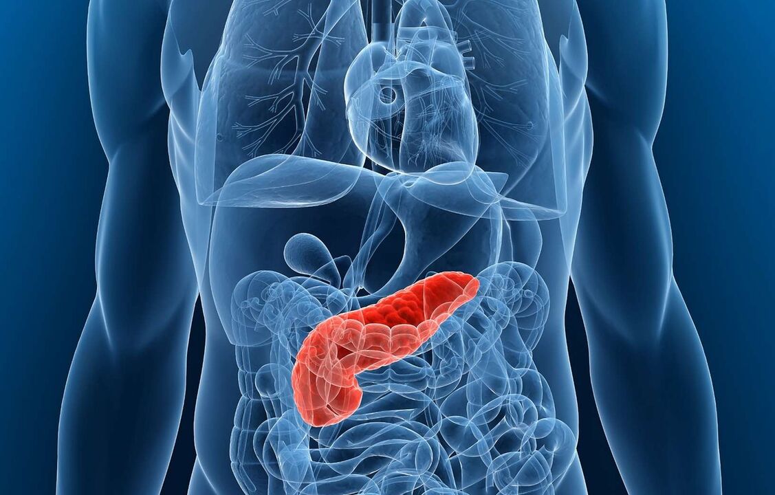 Inflamed pancreas na may pancreatitis